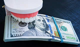 Mouth mold biting down on money to signify cost of teeth whitening in Marlton
