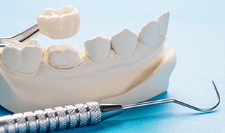 Dental crown being placed over a plaster model abutment tooth next to dental instruments