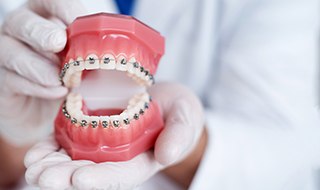 An orthodontist showing how braces are arranged on teeth