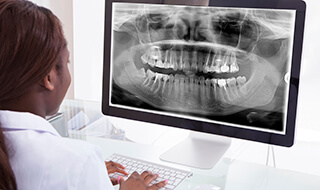 Dentist looking at digital x-ray